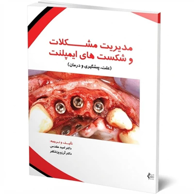 کتاب مدیریت مشکلات و شکستهای ایمپلنت