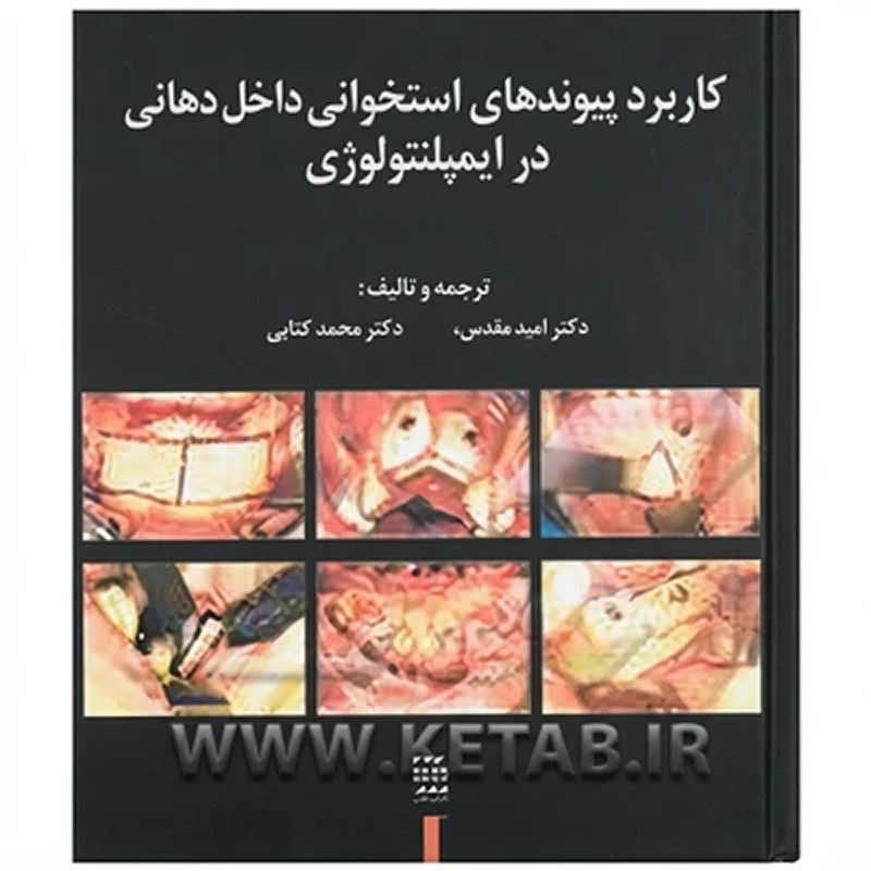 کتاب کاربرد پیوندهای استخوانی داخل دهانی در ایمپلنتولوژی