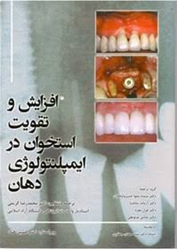 کتاب افزایش و تقویت استخوان در ایمپلنتولوژی دهان