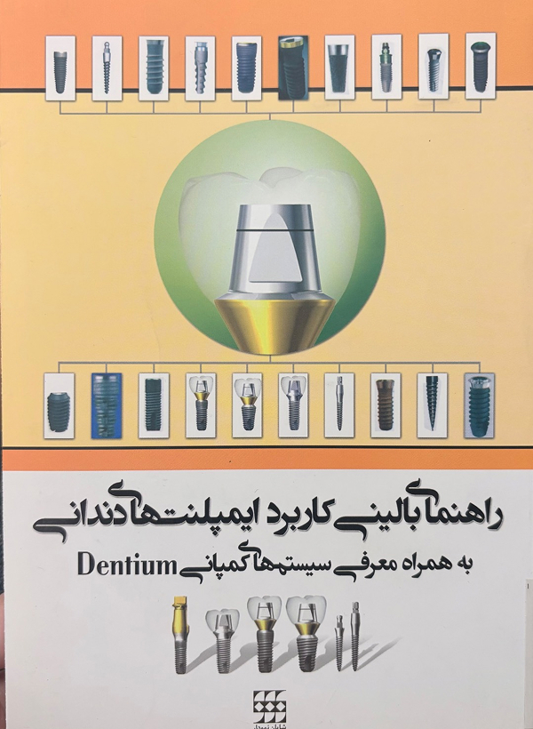 راهنمای بالینی کاربرد ایمپلنت‌های دندانی به همراه معرفی سیستم‌های کمپانی دنتیوم