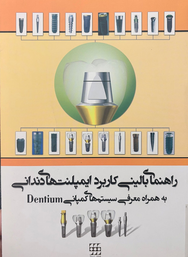 راهنمای بالینی کاربرد ایمپلنتهای دندانی به همراه معرفی سیستمهای کمپانی دنتیوم